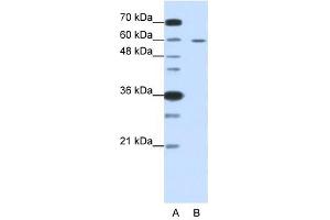 Western Blot showing FZD5 antibody used at a concentration of 1-2 ug/ml to detect its target protein. (FZD5 抗体)