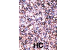 Immunohistochemistry (IHC) image for anti-Melanoma Antigen Family D, 2 (MAGED2) antibody (ABIN3002534) (MAGED2 抗体)