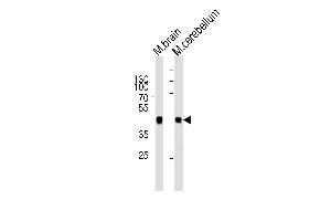 Western blot analysis of lysates from mouse brain and mouse cerebellum tissue lysate (from left to right), using ZDHHC14 Antibody (Center) (ABIN6243381 and ABIN6577546). (ZDHHC14 抗体  (AA 283-317))
