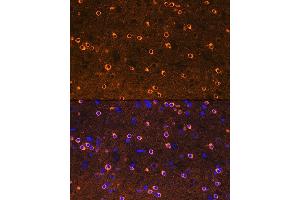Immunofluorescence (IF) image for anti-Dihydropyrimidinase-Like 2 (DPYSL2) antibody (ABIN7266770)