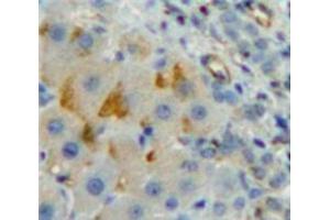 IHC-P analysis of Liver tissue, with DAB staining. (CD8B 抗体  (AA 22-175))