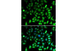 Immunofluorescence analysis of MCF-7 cells using RAE1 antibody (ABIN5974056). (RAE1 抗体)