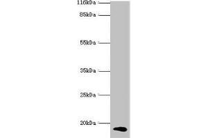 Western blot All lanes: CALML5 antibody at 2 μg/mL + A431 whole cell lysate Secondary Goat polyclonal to rabbit IgG at 1/10000 dilution Predicted band size: 16 kDa Observed band size: 16 kDa (CALML5 抗体  (AA 2-146))