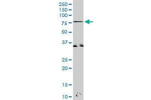 Western Blotting (WB) image for anti-zeta-Chain (TCR) Associated Protein Kinase 70kDa (ZAP70) (AA 1-619) antibody (ABIN521447)