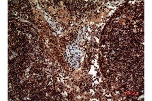 Immunohistochemistry (IHC) analysis of paraffin-embedded Human Lymph Nodes, antibody was diluted at 1:100. (TRAIL 抗体  (Internal Region))