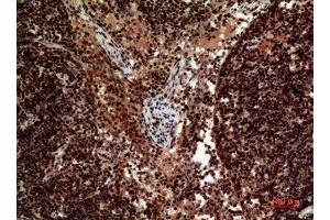 Immunohistochemistry (IHC) analysis of paraffin-embedded Human Lymph Nodes, antibody was diluted at 1:100.