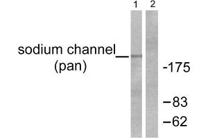 Western blot analysis of extracts from HuvEc cells, using Sodium Channel-pan Antibody (ABIN5976507). (Sodium Channel 抗体  (Internal Region, pan))