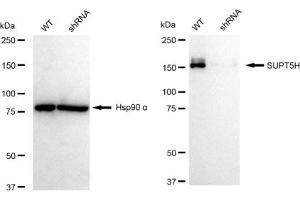 Western blotting analysis using SUPT5H antibody (ABIN7800586). (Recombinant SUPT5H 抗体)