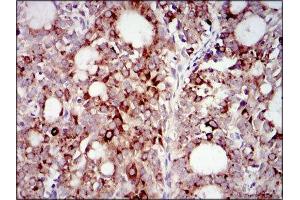 Immunohistochemistry (IHC) image for anti-Phosphoinositide 3 Kinase, p85 alpha (PI3K p85a) (AA 159-388) antibody (ABIN1844692) (PIK3R1 抗体  (AA 159-388))