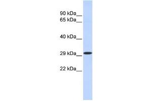 Western Blotting (WB) image for anti-Kruppel-Like Factor 14 (KLF14) antibody (ABIN2458210) (KLF14 抗体)