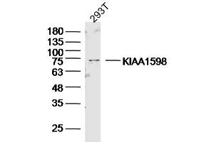 293T lysates probed with KIAA1598 Polyclonal Antibody, Unconjugated  at 1:300 dilution and 4˚C overnight incubation. (Shootin-1 (SHTN1) (AA 21-130) 抗体)
