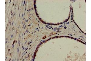 Immunohistochemistry (IHC) image for anti-Excision Repair Cross-Complementing Rodent Repair Deficiency, Complementation Group 4 (ERCC4) (AA 656-753) antibody (ABIN7150279)
