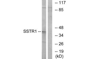 Western blot analysis of extracts from COS-7 cells, using SSTR1 antibody. (SSTR1 抗体  (N-Term))