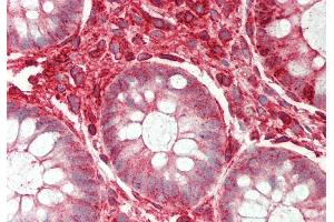 Immunohistochemistry (IHC) image for anti-ST3 beta-Galactoside alpha-2,3-Sialyltransferase 4 (ST3GAL4) (Middle Region) antibody (ABIN2782704)