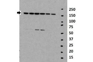Researcher: Daolin Tang, University of Pittsburgh Medical Center Species+tissue/cell type: Lane 1-6: 30ug mouse MEF lysate Primary antibody dilution: 1:2000 (TNKS 抗体  (Middle Region))