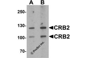 Western Blotting (WB) image for anti-Crumbs Homolog 2 (CRB2) antibody (ABIN1077416) (CRB2 抗体)