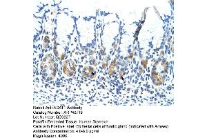 Rabbit Anti-ADAT1 Antibody  Paraffin Embedded Tissue: Human Stomach Cellular Data: Epithelial cells of fundic gland Antibody Concentration: 4. (ADAT1 抗体  (C-Term))