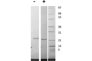 SDS-PAGE of Human Interleukin-11 Recombinant Protein SDS-PAGE of Human Interleukin-11 Recombinant Protein. (IL-11 蛋白)