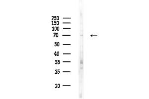anti-Chromosome 10 Open Reading Frame 2 (C10ORF2) (C-Term) antibody