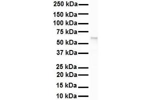 WB Suggested Anti-SNRP70 antibody Titration: 1 ug/mL Sample Type: Human Raji (SNRNP70 抗体  (N-Term))