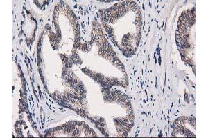 Image no. 1 for anti-Eukaryotic Translation Initiation Factor 4E Family Member 2 (EIF4E2) antibody (ABIN1497992) (EIF4E2 抗体)