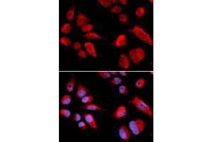 Immunofluorescence analysis of U2OS cells using CBS antibody (ABIN5970665). (CBS 抗体)