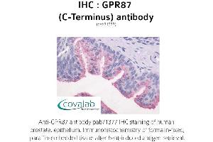 Image no. 1 for anti-G Protein-Coupled Receptor 87 (GPR87) (C-Term) antibody (ABIN1735186) (GPR87 抗体  (C-Term))