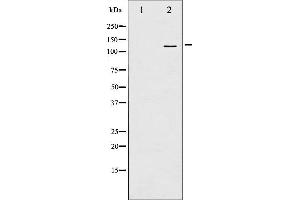 Western blot analysis of FAK phosphorylation expression in EGF treated 293 whole cell lysates,The lane on the left is treated with the antigen-specific peptide.