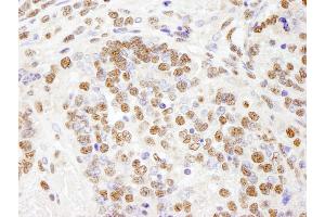 anti-PHD Finger Protein 8 (PHF8) (AA 650-700) antibody