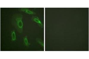 Immunofluorescence analysis of HeLa cells, using CD227/Mucin 1 (Ab-1243) Antibody. (MUC1 抗体  (AA 1204-1253))