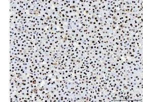 IHC analysis of PC4/SUB1 using anti-PC4/SUB1 antibody (ABIN7602185).