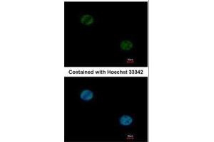 ICC/IF Image Immunofluorescence analysis of paraformaldehyde-fixed HeLa, using FOXA1, antibody at 1:1000 dilution. (FOXA1 抗体  (C-Term))