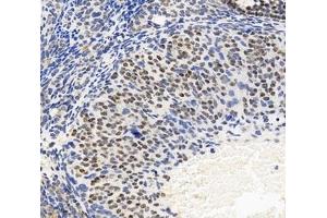 Immunohistochemistry analysis of paraffin-embedded mouse ovary using,FOXL2 (ABIN7073971) at dilution of 1: 6000