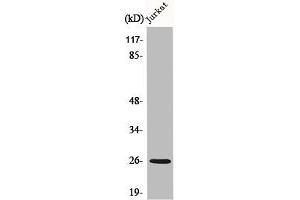 Western Blot analysis of Jurkat cells using C1q-B Polyclonal Antibody (C1QB 抗体  (C-Term))