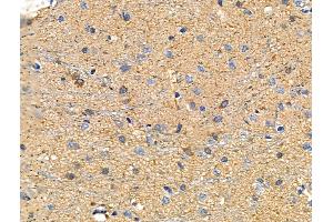 ABIN6258262 and ABIN6273481 at 1/100 staining Rat brain tissue by IHC-P. (MAP3K12 抗体  (N-Term))