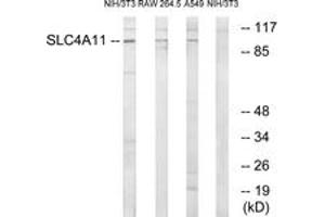 Western blot analysis of extracts from NIH-3T3/RAW264. (SLC4A11 抗体  (AA 291-340))