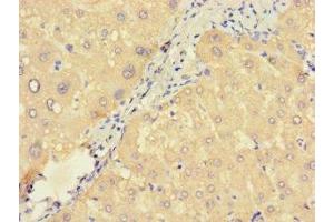 Immunohistochemistry of paraffin-embedded human liver tissue using ABIN7166376 at dilution of 1:100 (ZNF738 抗体  (AA 1-137))