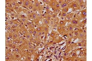 IHC image of ABIN7168014 diluted at 1:200 and staining in paraffin-embedded human liver tissue performed on a Leica BondTM system. (RND1 抗体  (AA 1-106))
