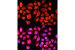 Immunofluorescence analysis of HeLa cells using MRPS28 Polyclonal Antibody (ABIN6133074, ABIN6144041, ABIN6144042 and ABIN6220731) at dilution of 1:100 (40x lens). (MRPS28 抗体  (AA 1-187))