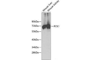 Western blot analysis of extracts of various cell lines using PCK1 Polyclonal Antibody. (PCK1 抗体)