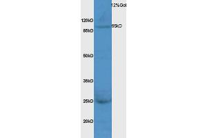 Rat liver lysates probed with Anti MPS1 Polyclonal Antibody, Unconjugated (ABIN873234) at 1:200 overnight at 4 °C. (Mps1 抗体  (AA 601-700))
