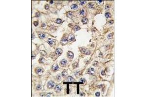Formalin-fixed and paraffin-embedded human testis tissue reacted with EPHA10 antibody (Center), which was peroxidase-conjugated to the secondary antibody, followed by DAB staining. (EPH Receptor A10 抗体  (AA 440-469))