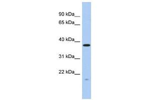WB Suggested Anti-RWDD2A Antibody Titration: 0. (RWDD2A 抗体  (N-Term))