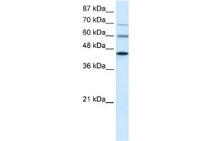 WB Suggested Anti-PRMT3 Antibody Titration:  0. (PRMT3 抗体  (Middle Region))