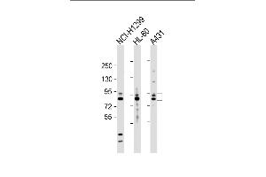 Western Blotting (WB) image for anti-Matrix Metallopeptidase 9 (Gelatinase B, 92kDa Gelatinase, 92kDa Type IV Collagenase) (MMP9) (AA 644-673), (C-Term) antibody (ABIN390154)