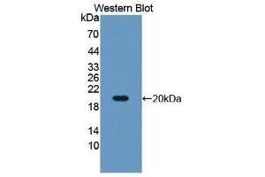Western Blotting (WB) image for anti-Insulin-Like Growth Factor Binding Protein 3 (IGFBP3) (AA 152-292) antibody (ABIN1172098)