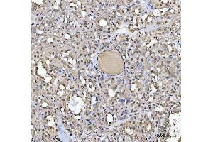 IHC analysis of SAP130 using anti-SAP130 antibody (ABIN7601247).