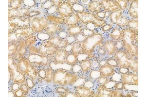 anti-Mitochondrial Ribosomal Protein L24 (MRPL24) (Internal Region) antibody