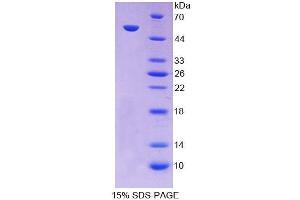 SDS-PAGE analysis of Human PC Protein. (PC 蛋白)