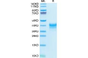 SDS-PAGE (SDS) image for Folate Receptor 1 (Adult) (FOLR1) (AA 25-233) protein (His tag) (ABIN7274662)